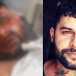 ‘Desespero, chocados’, diz irmã de tatuador que ficou cego ao ter soda cáustica jogada no rosto pela ex.